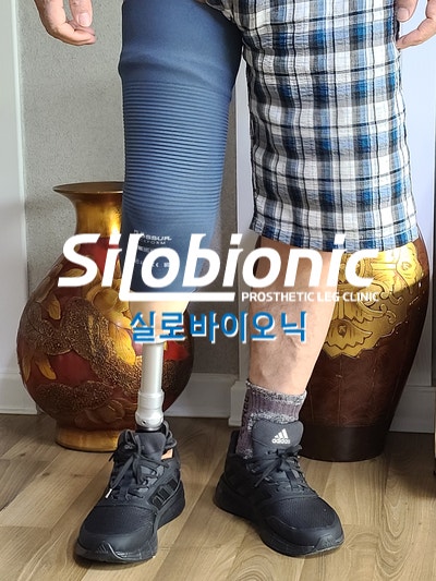 무릎 위까지 슬리브를 덮은 흡착 방식 하퇴 의족을 신고 선 고객님