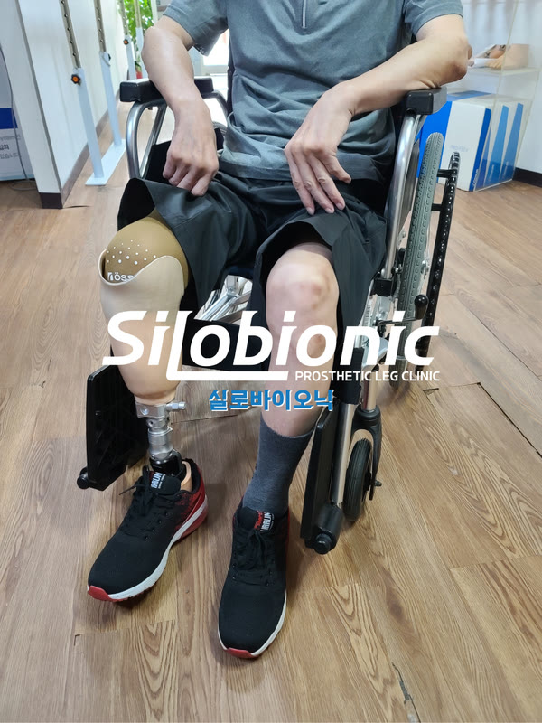 휠체어에 앉아 무릎 아래에 하퇴 의족을 착용한 다리
