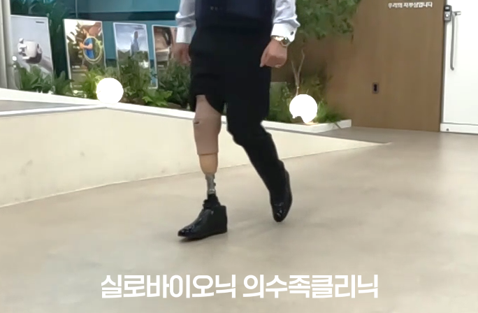 정장 구두를 신고 하퇴 의족으로 걷는 고객님의 다리