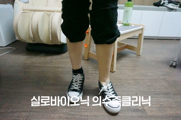 운동화를 신고 선 두 다리, 한쪽 종아리에 실리콘 피부 커버 착용