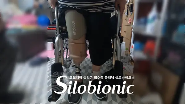 휠체어에 앉아 하퇴 절단단에 라이너를 신은 모습과 의족