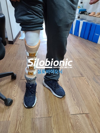 複数のストラップとバックルで固定する前開き式の下腿義足で立つ