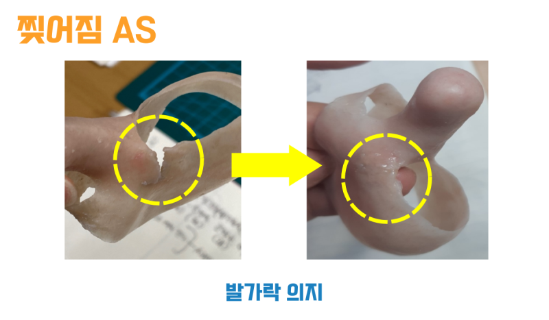 A silicone toe prosthesis with a torn edge, before and after repair