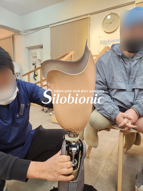 クリニックで、膝継手を取り付けた大腿義足のソケットを調整する義肢装具士