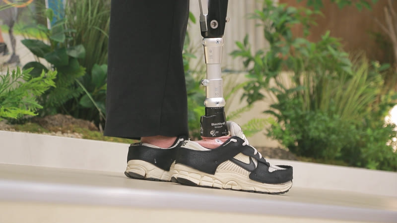 スニーカーを履いた油圧式足継手付きの足部と、大腿義足の下部