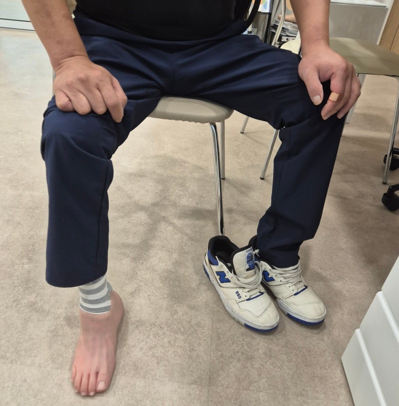 新しい足部義足を片脚に着けて座っているお客様